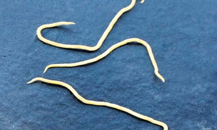solution to the problem of worms solution to the problem of worms