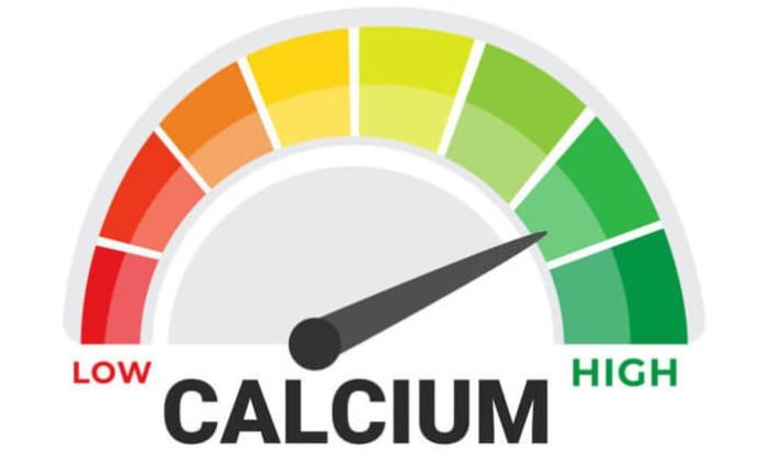 calcium score determined by Cardiac CT Scan