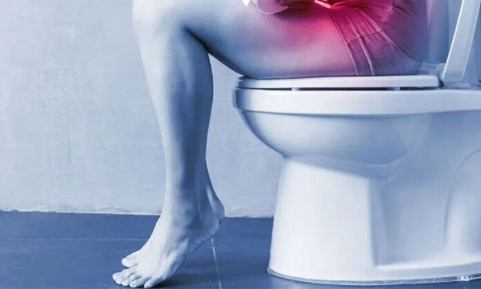 Healthy foods like fruits, vegetables, and water intake helping to relieve constipation naturally through diet and lifestyle changes.