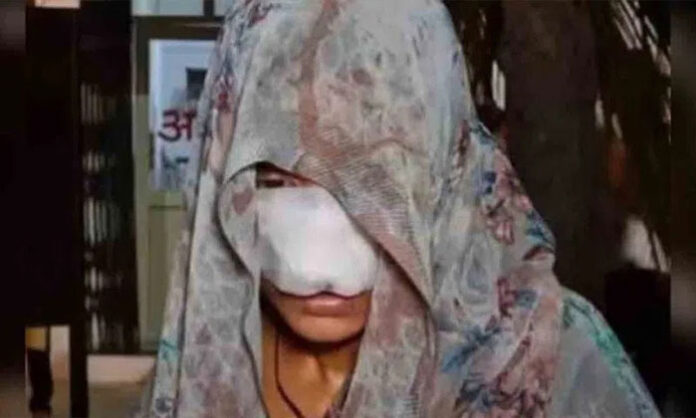 Victim Pana treated in hospital after being severely bitten on the nose and cheek by her husband in Hamirpur, Uttar Pradesh; police register case and search for accused.
