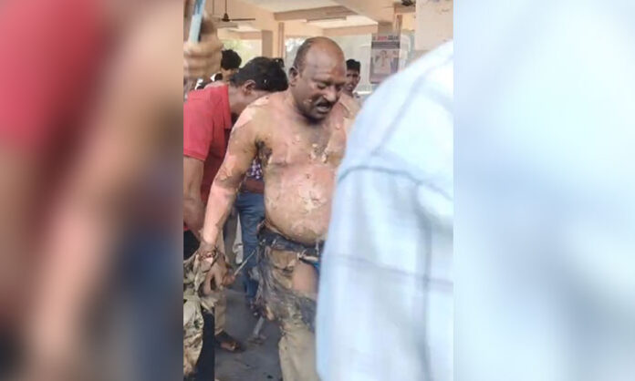 RTC driver Shankar Goud in Narsampet attempted self-immolation during protest at RTC depot
