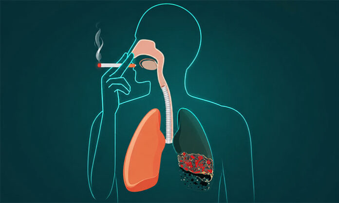 Illustration showing health improvements and body recovery process after quitting smoking including lungs, heart, and blood circulation