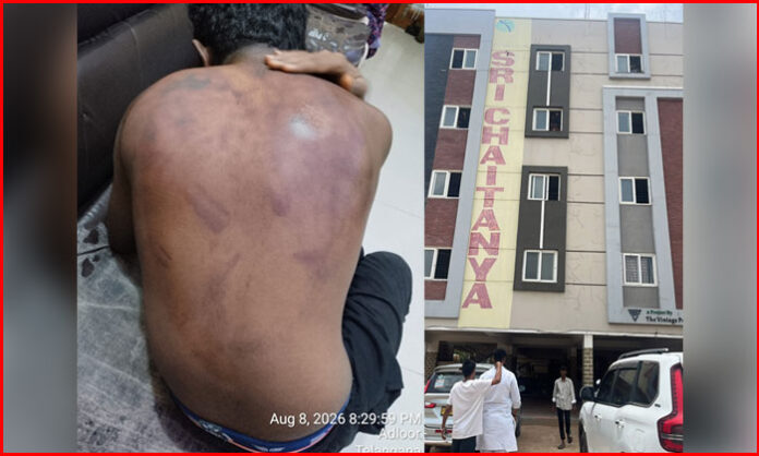 Student allegedly assaulted by fellow hostel students in a ragging incident at Dammaiguda