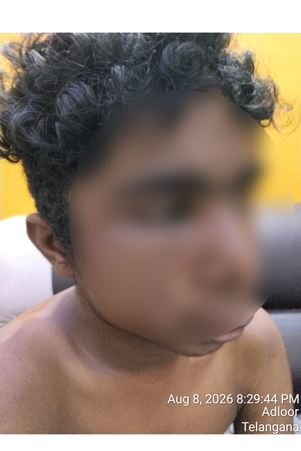 Dammaiguda hostel student assault.1