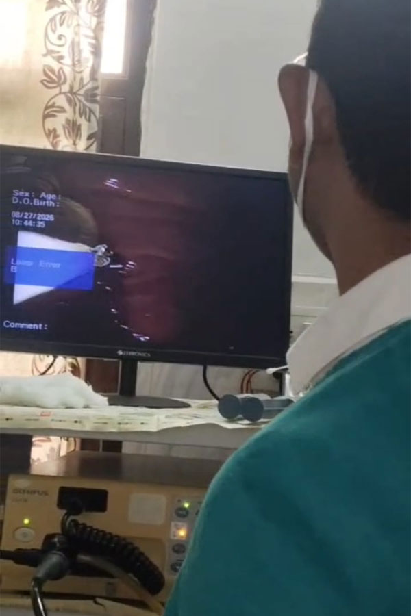 Five Rupee Coin Removed Through Endoscopy1